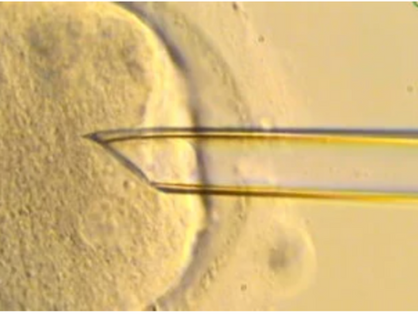 Three Person IVF Cycle